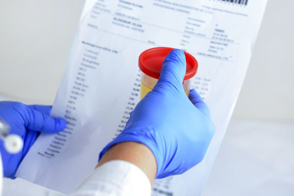 Medical sample is held up in front of printed results